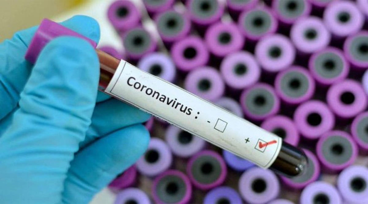 Se mantiene atenta la Red de Vigilancia Epidemiológica de BCS por el coronavirus