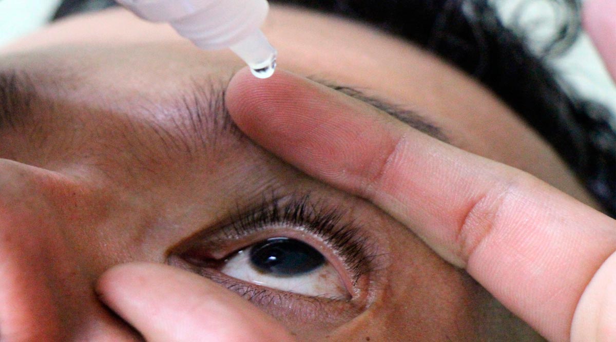 La conjuntivitis suele presentarse con mayor frecuencia en febrero y marzo en BCS